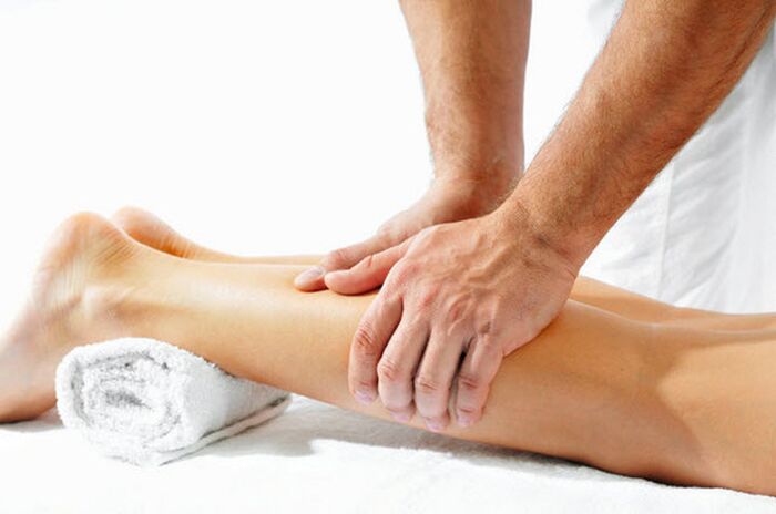 varicose veins in the legs