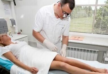 Diagnosis of varicose veins