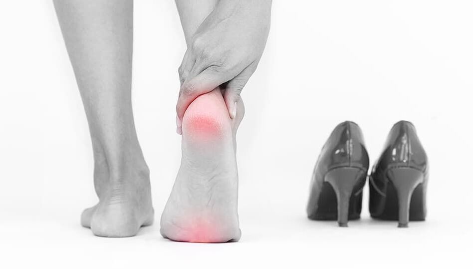 the cause of varicose veins are uncomfortable shoes